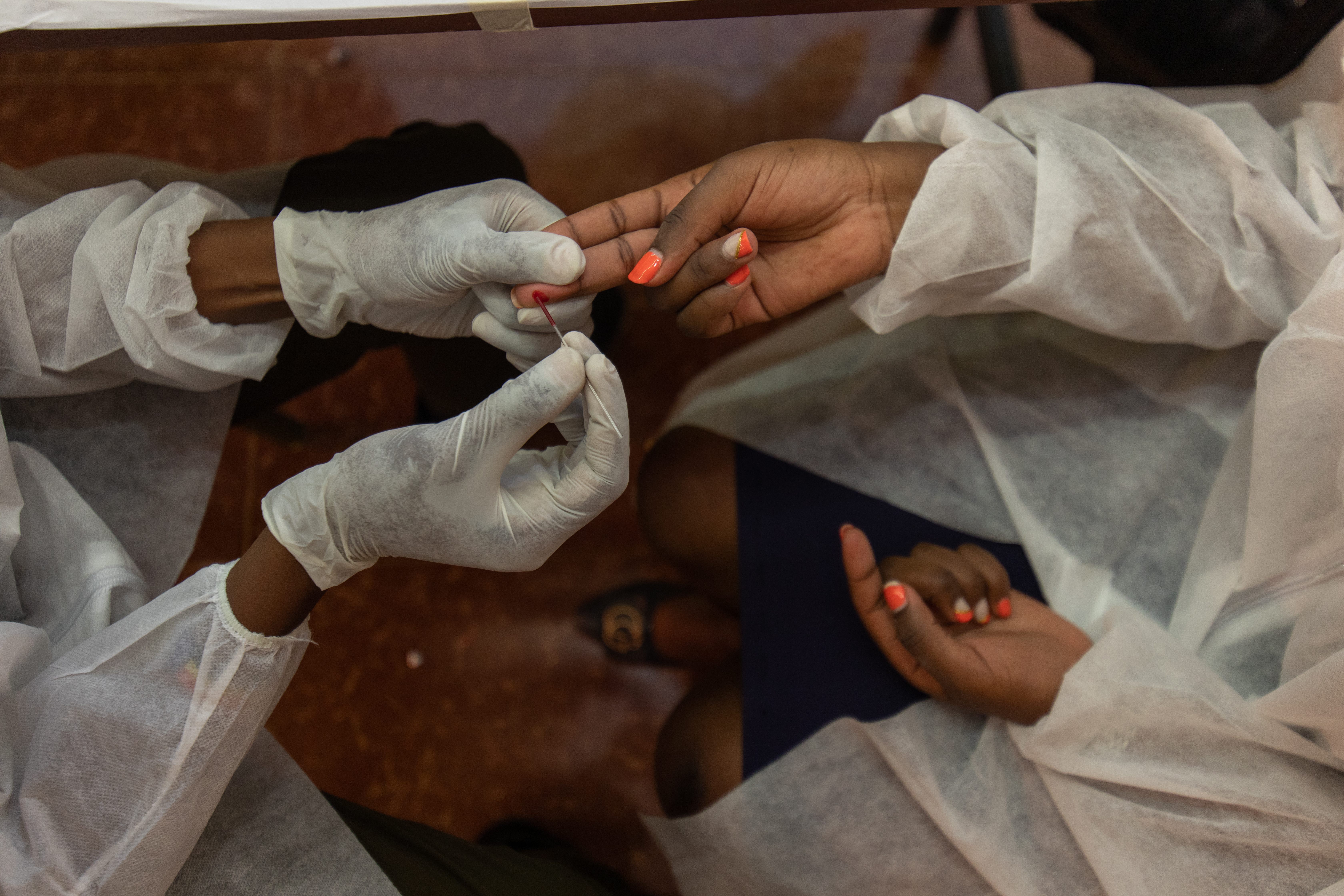 Testing of HIV patient